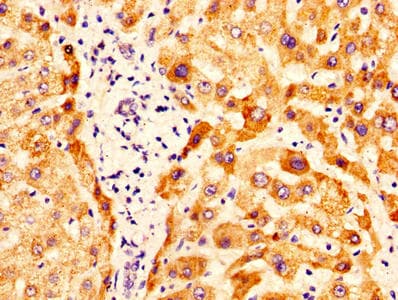 Polyclonal Rabbit anti-Human OTC Antibody (aa33-354)