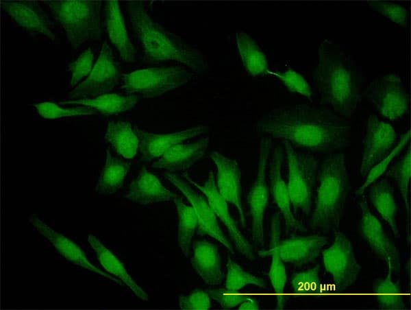 PBK / TOPK Antibody (clone 1E11)