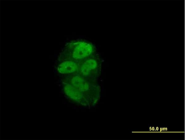 PR / Progesterone Receptor Antibody (clone 1B11)
