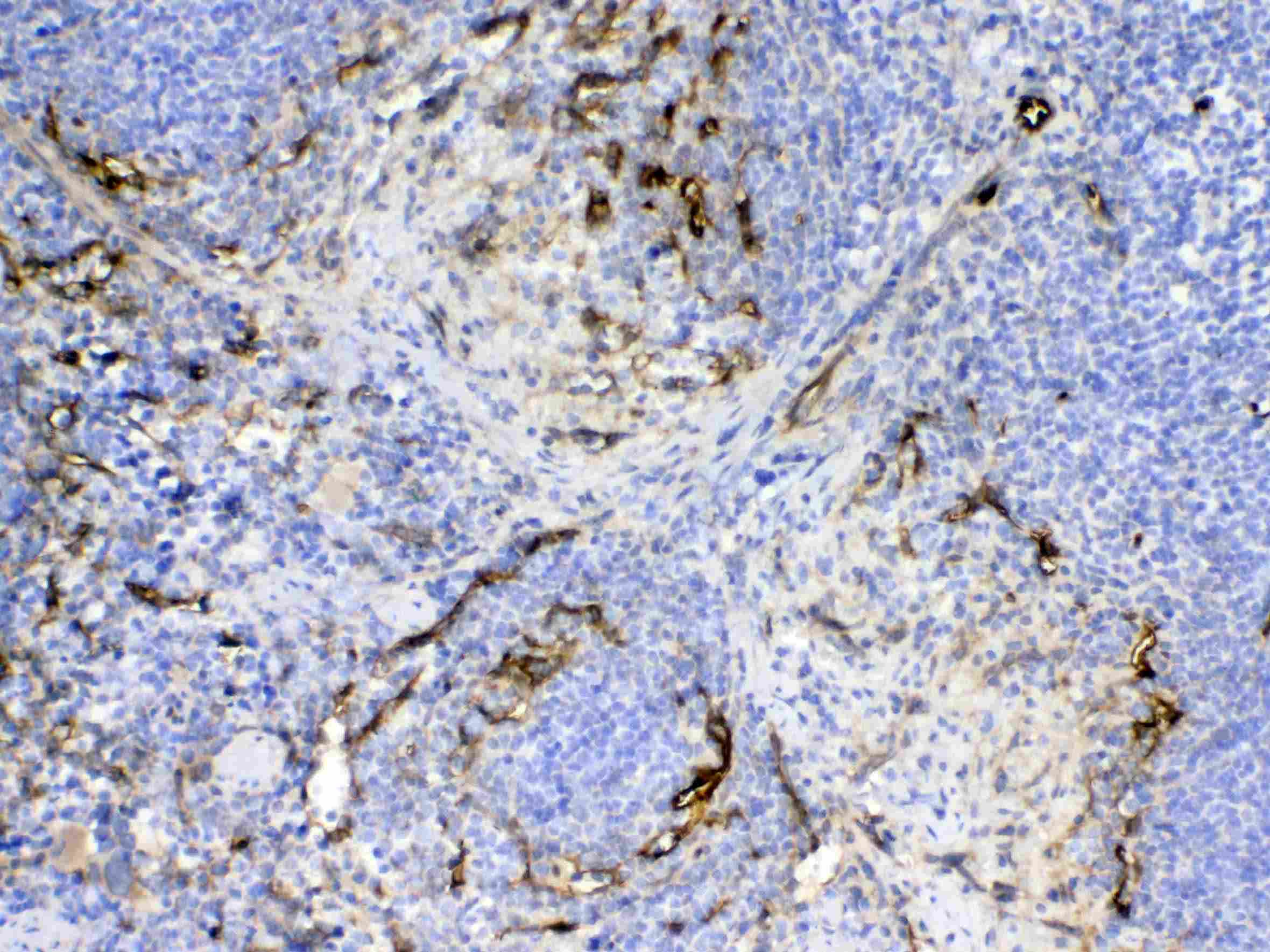 CD105 Antibody