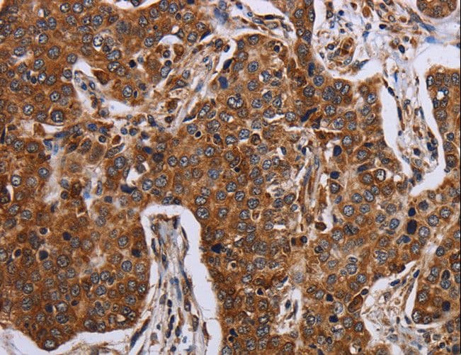 ACP6 Antibody