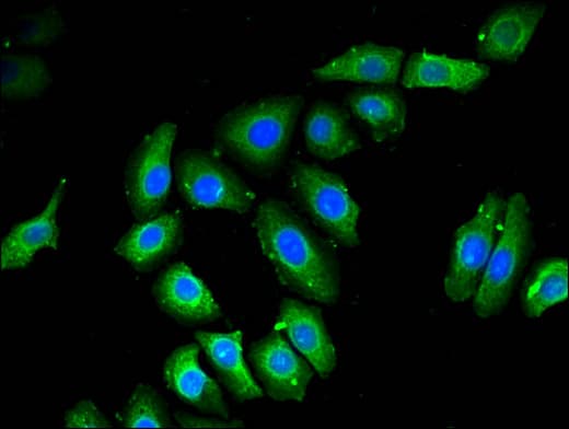 NOB1 / NOB1P Antibody