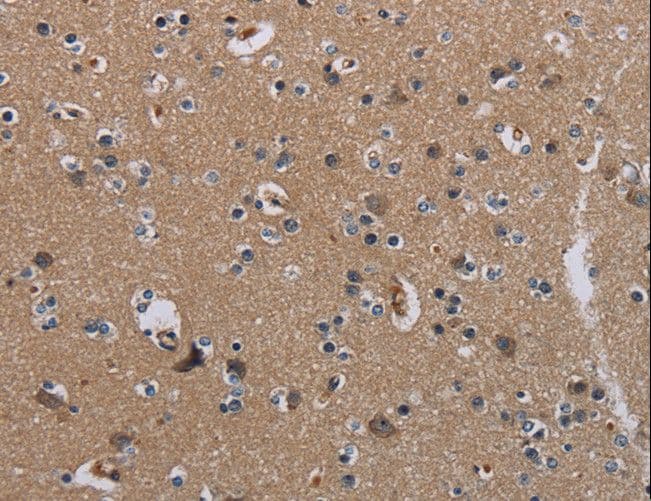 PIDD1 Antibody