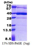 Human HS3ST1 Protein (Recombinant His)