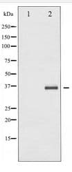 NFKBIB / IKB Beta / IKBB Antibody