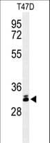 DKK1 Antibody (aa58-84)