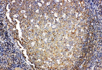 Polyclonal Rabbit anti-Human IL4 Antibody (aa72-88, IHC, WB)