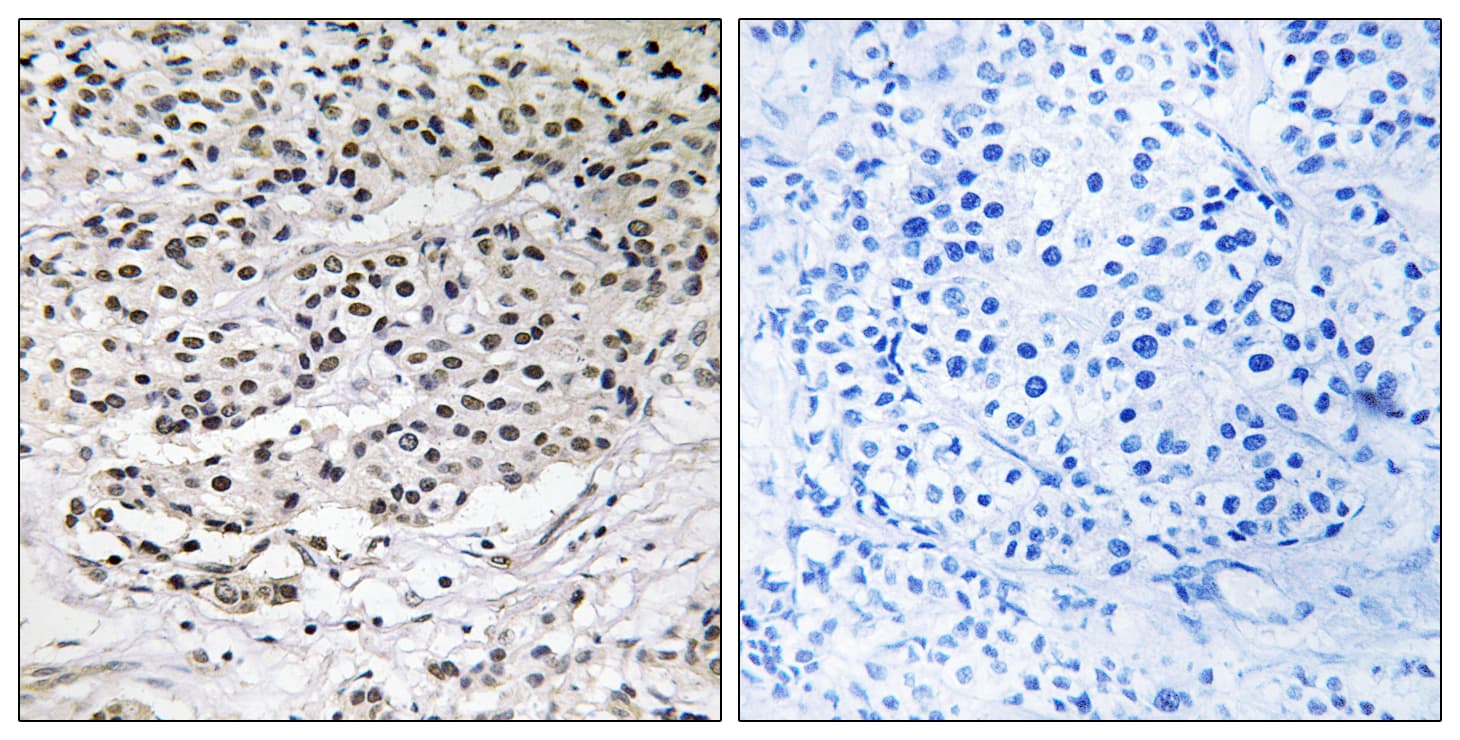 Polyclonal Rabbit anti-Human CEP131 / AZI1 Antibody (aa311-360, IHC, WB)