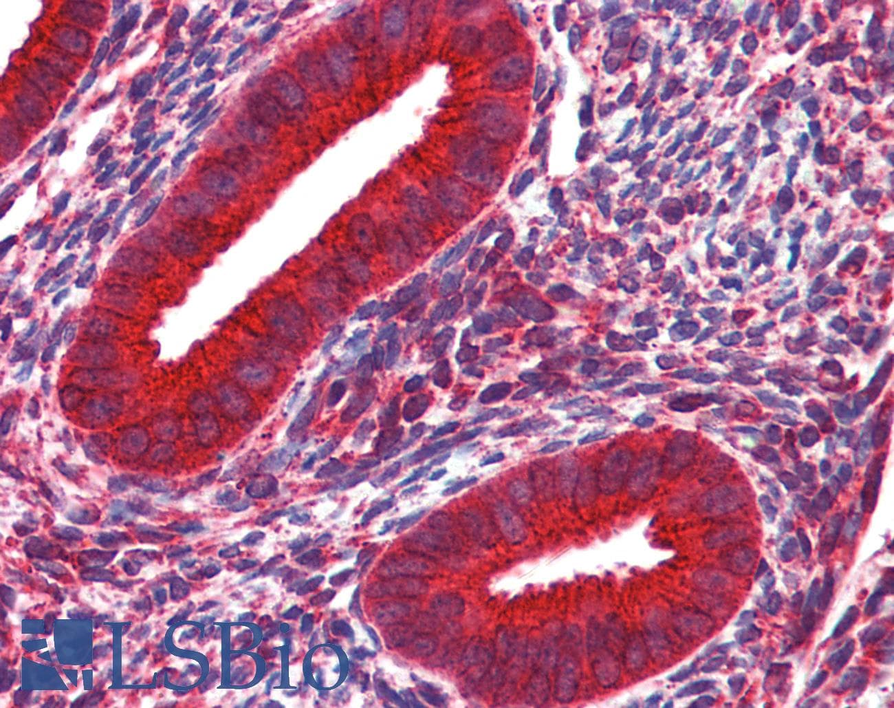 IHC-plus™ WNT5A Antibody (clone 6F2)
