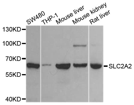 SLC2A2 / GLUT2 Antibody