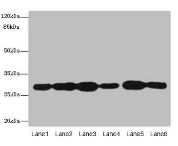 Polyclonal Rabbit anti-Human PMM2 Antibody (IHC, WB)