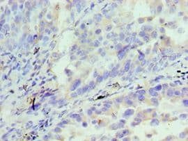 AcPL / IL18RAP Antibody (aa390-599)