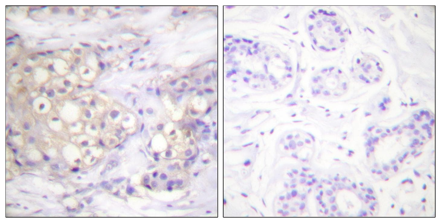 PRKCA / PKC-Alpha Antibody (phospho-Thr638)