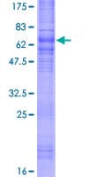 Human SSTR1 Protein (Recombinant GST)