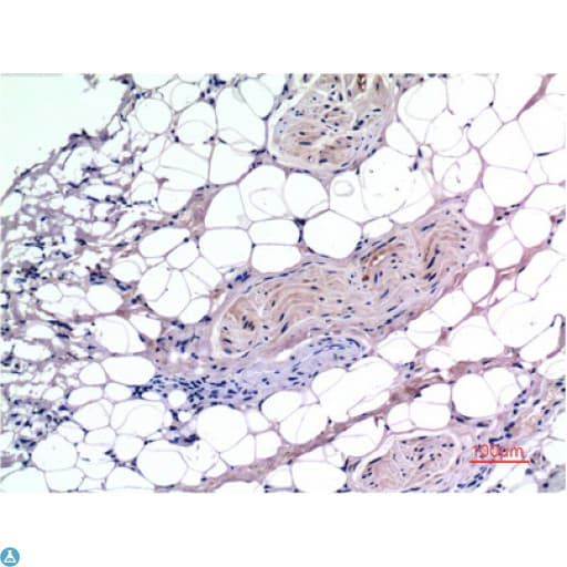 SMAD3 Antibody