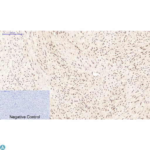PPARD / PPAR Delta Antibody