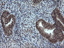 ESRRG / ERR Gamma Antibody (clone OTI6G1)
