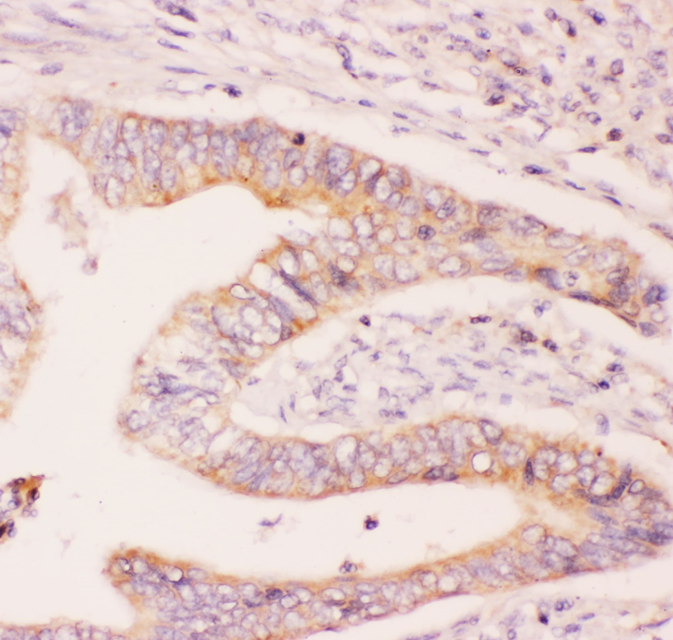 MCL1 / MCL 1 Antibody (aa1-350)