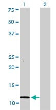 S100A1 / S100-A1 Antibody (clone 1D5)