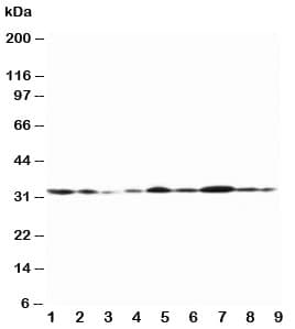 GJB1 / CX32 / Connexin 32 Antibody (aa215-231)