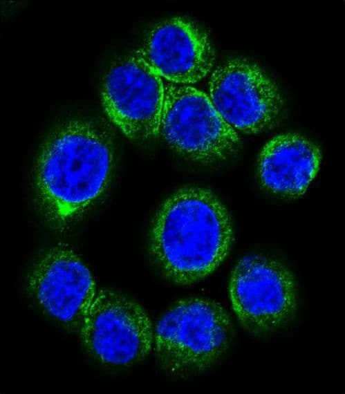 EPOR / EPO Receptor Antibody (aa329-357)