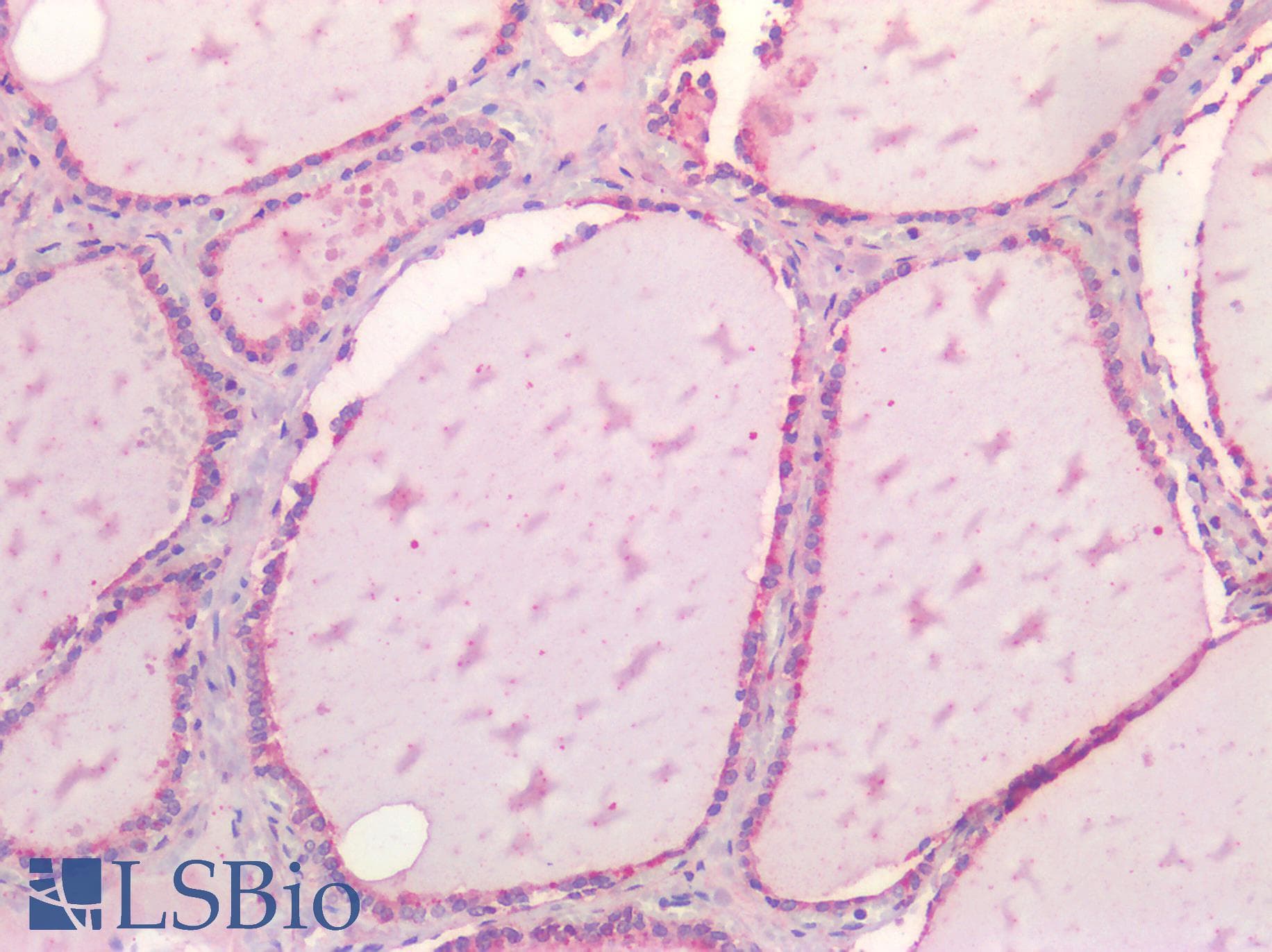 IHC-plus™ NOTCH2 Antibody