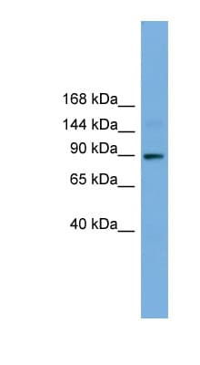 TTC27 Antibody (aa251-300)