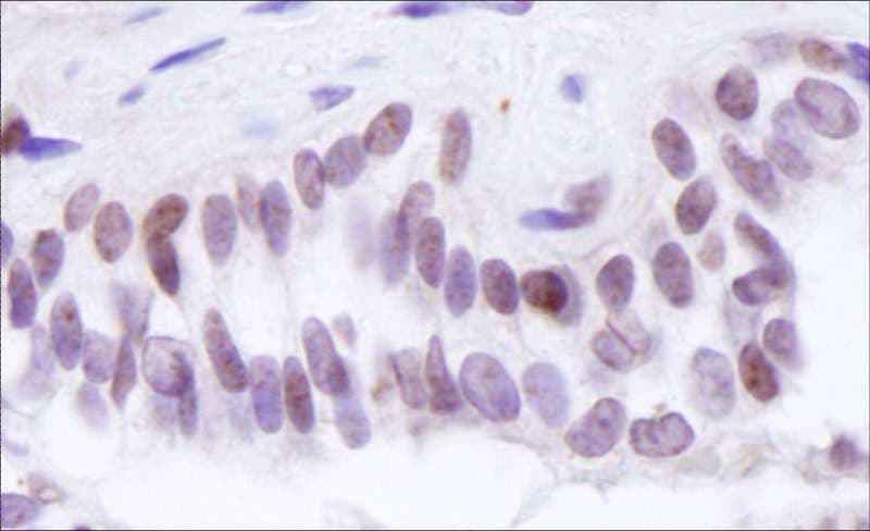 Polyclonal Rabbit anti-Human BRD8 Antibody (aa225-275 of isoform 2, IHC)