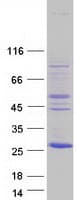 Human NKIRAS2 Protein (Recombinant Myc-DDK (Flag))