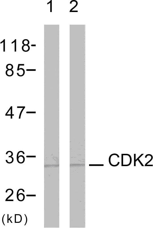 Polyclonal Rabbit anti-Human CDK2 Antibody (p160, WB)