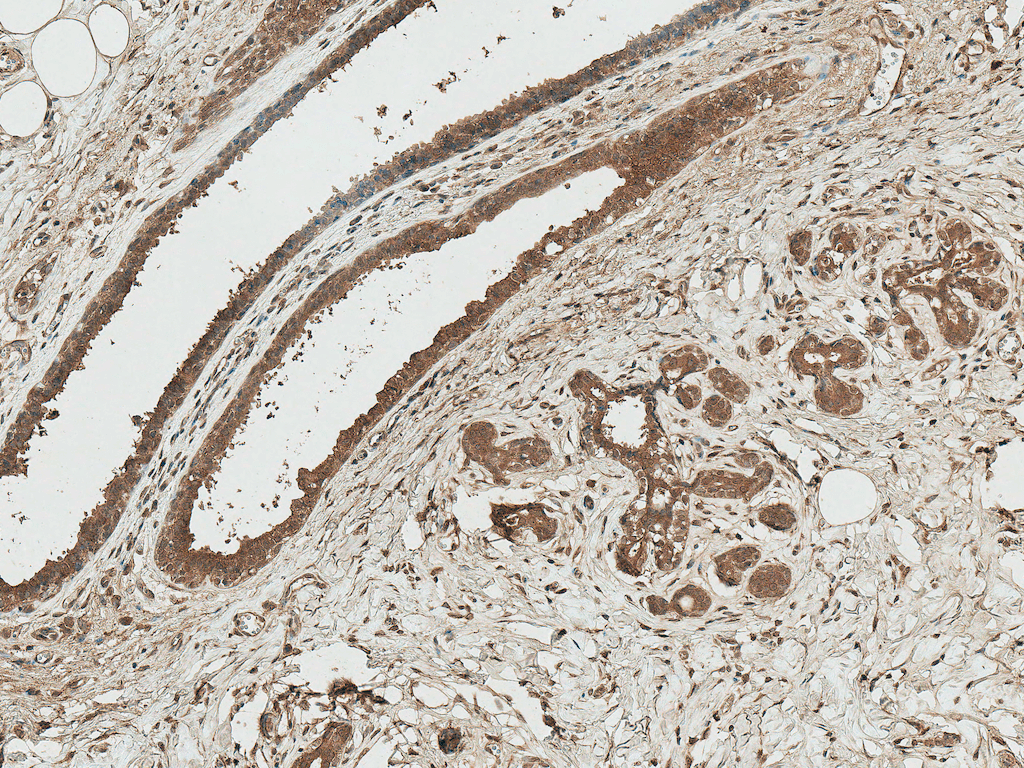 AXIN1 / Axin-1 Antibody (Biotin)