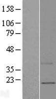 UQCC2 / MNF1 Protein (Over-Expression Lysate Myc-DDK (Flag))