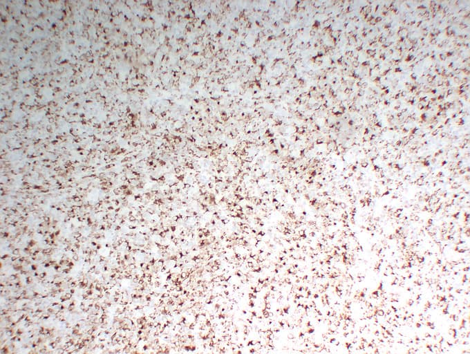 CD68 Antibody (clone ABT-CD68)
