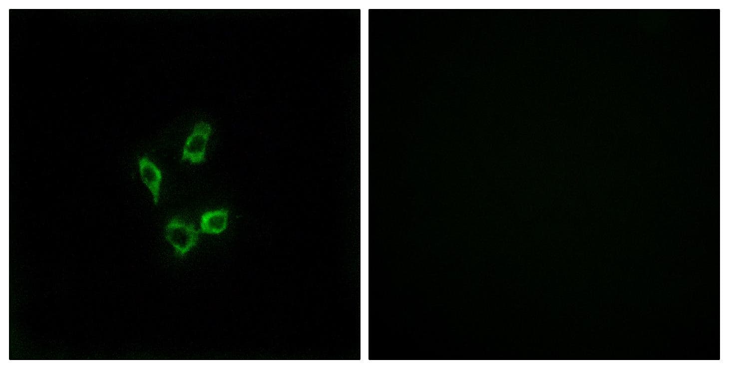 Polyclonal Rabbit anti-Human CYP4Z1 Antibody (IHC, IF)