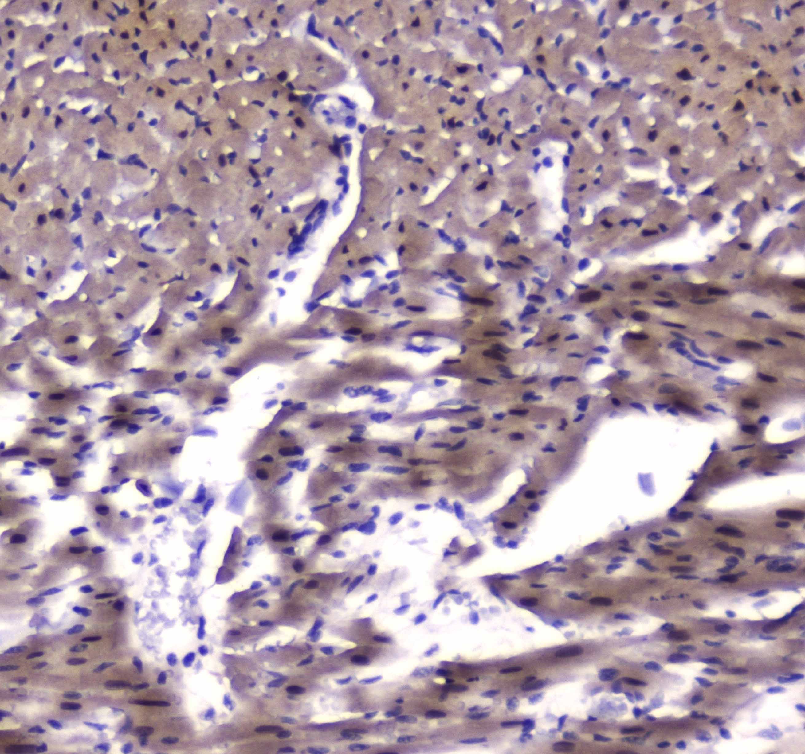 ESRRG / ERR Gamma Antibody