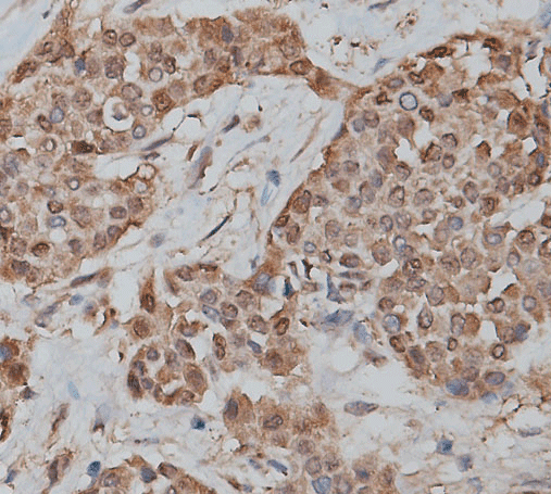 Polyclonal Rabbit anti-Human CEACAM8 / CD66b Antibody (IHC, WB)