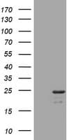 VILIP / VSNL1 Antibody (clone OTI5B4)