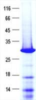 Human HAND1 Protein (Recombinant His, N-Terminal)