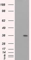 ERCC1 Antibody (clone OTI2H5)