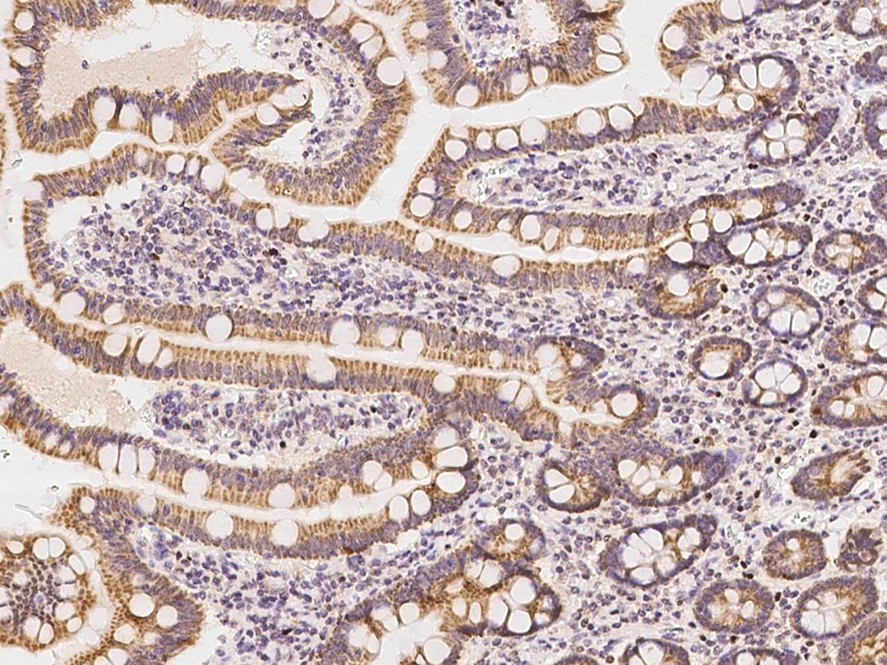 VPS26A / VPS26 Antibody
