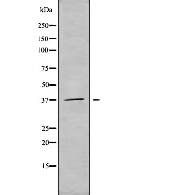 B3GALT6 Antibody