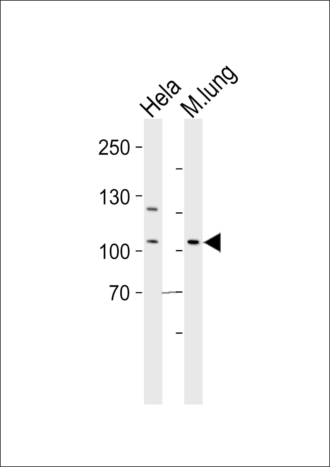 EPHA4 / EPH Receptor A4 Antibody (aa309-342)