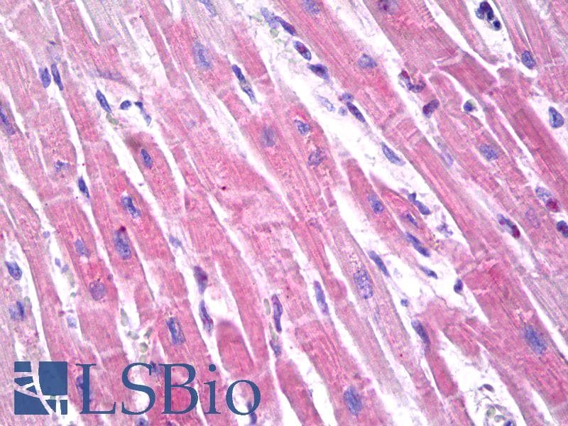IHC-plus™ Polyclonal Rabbit anti-Human NPPB / BNP Antibody (Preservative Free, IHC)