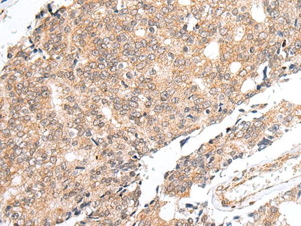 Polyclonal Rabbit anti-Human PRELID1 Antibody (IHC)
