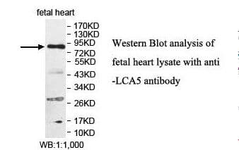 LCA5 Antibody (aa37-222)