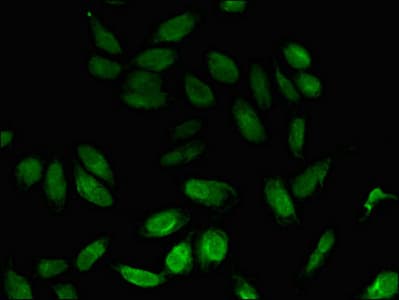 NPL / C112 Antibody