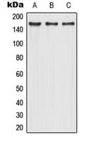 Mannose Receptor / CD206 Antibody (Internal)