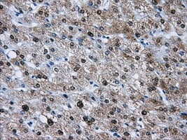 Monoclonal Mouse anti-Human HDAC10 Antibody (clone OTI5E2, IHC, WB)