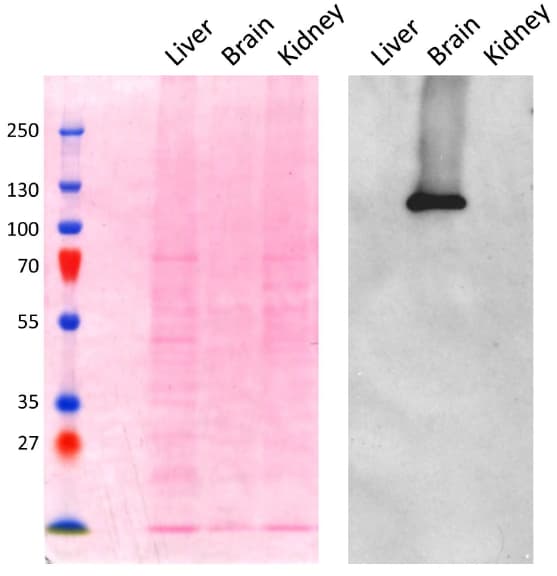 IHC-plus™ Polyclonal Goat anti-Human AP2A1 / AP2-Alpha Antibody (aa706-727, IHC, WB)