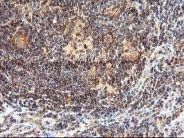 Monoclonal Mouse anti-Human LCMT1 Antibody (clone OTI2C9, IHC, WB)